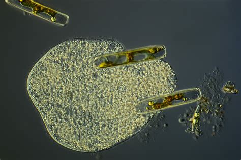  Heterotrichum! Un Cilié Fascinant aux Mouvements Ondulatoires et à l'Appetit Vorace