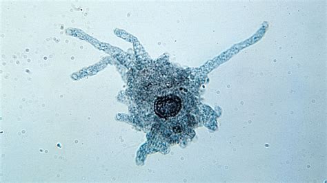  Olympus Amoeba: A Microscopic Marvel Exhibiting Unconventional Locomotion Techniques